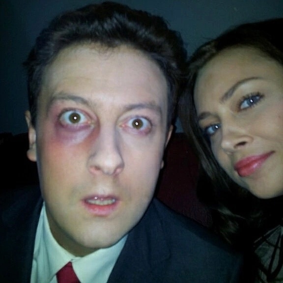 Побитый актер из универа